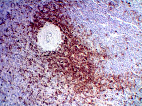 Immunohistochemistry (Formalin/PFA-fixed paraffin-embedded sections) - Anti-CD3 epsilon antibody (AB5690), expandable thumbnail