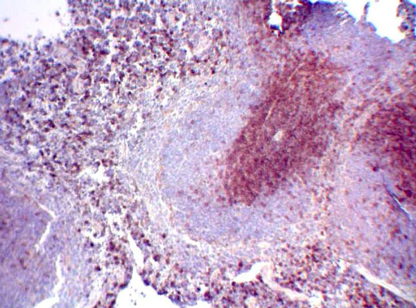 Immunohistochemistry (Formalin/PFA-fixed paraffin-embedded sections) - Anti-CD3 epsilon antibody (AB5690)