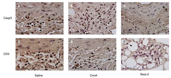 Immunohistochemistry (Formalin/PFA-fixed paraffin-embedded sections) - Anti-CD3 epsilon antibody (AB5690)