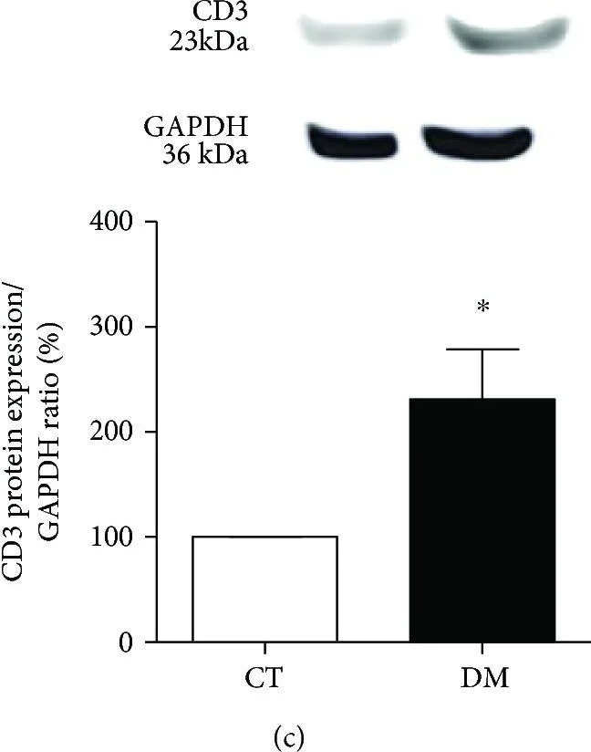 Western blot - Anti-CD3 epsilon antibody (AB5690)