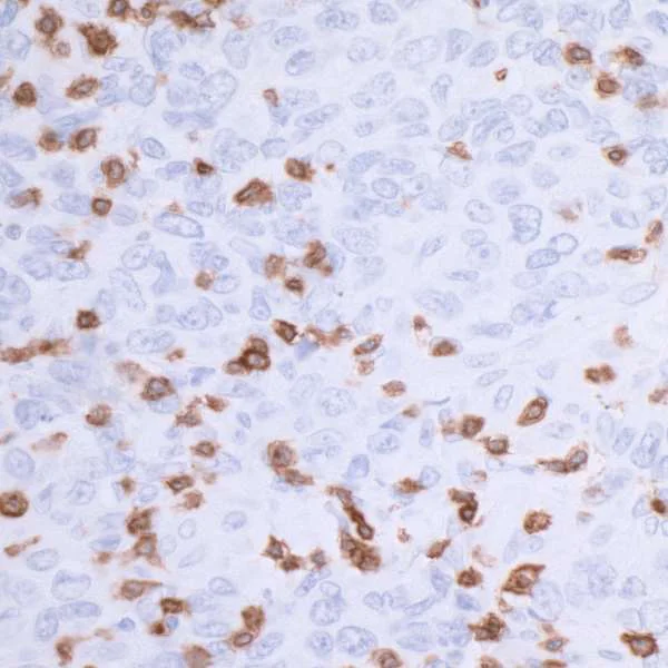 Immunohistochemistry (Formalin/PFA-fixed paraffin-embedded sections) - Anti-CD3 epsilon antibody [BL-298-5D12] (AB243873)