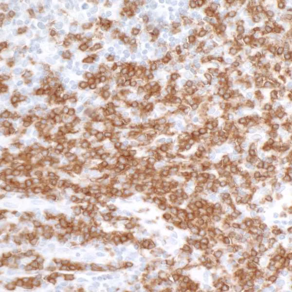 Immunohistochemistry (Formalin/PFA-fixed paraffin-embedded sections) - Anti-CD3 epsilon antibody [BL-298-5D12] (AB243873)