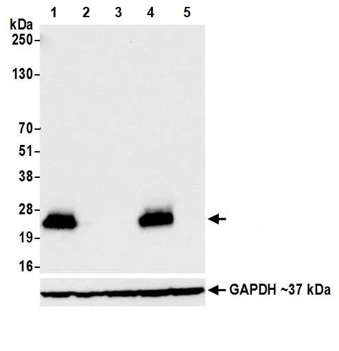 Western blot - Anti-CD3 epsilon antibody [BL-298-5D12] (AB243873)