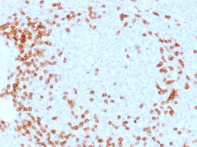 Immunohistochemistry (Formalin/PFA-fixed paraffin-embedded sections) - Anti-CD3 epsilon antibody [C3e/1931] (AB238083)
