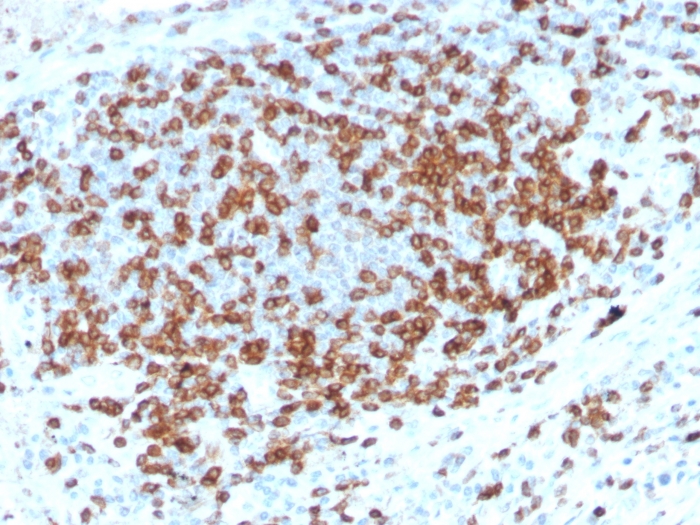 Immunohistochemistry (Formalin/PFA-fixed paraffin-embedded sections) - Anti-CD3 epsilon antibody [C3e/3125R] (AB270716), expandable thumbnail