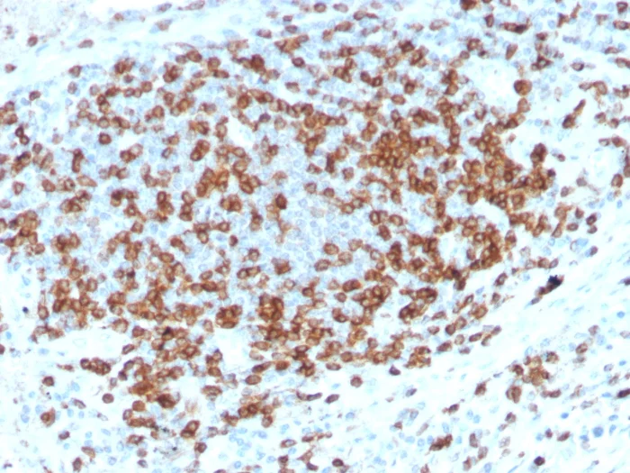Immunohistochemistry (Formalin/PFA-fixed paraffin-embedded sections) - Anti-CD3 epsilon antibody [C3e/3125R] (AB270716)