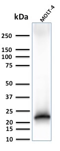 Western blot - Anti-CD3 epsilon antibody [C3e/3125R] (AB270716), expandable thumbnail