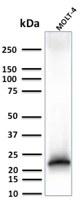 Western blot - Anti-CD3 epsilon antibody [C3e/3125R] (AB270716)