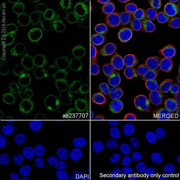 Immunocytochemistry/ Immunofluorescence - Anti-CD3 epsilon antibody [CAL54] (AB237707), expandable thumbnail
