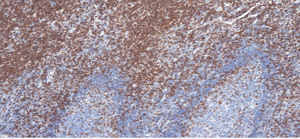 Immunohistochemistry (Formalin/PFA-fixed paraffin-embedded sections) - Anti-CD3 epsilon antibody [CAL54] (ab237707), expandable thumbnail