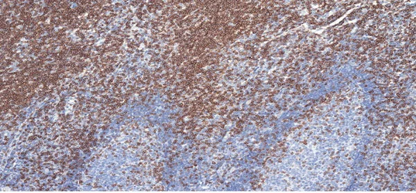 Immunohistochemistry (Formalin/PFA-fixed paraffin-embedded sections) - Anti-CD3 epsilon antibody [CAL54] (AB237707)