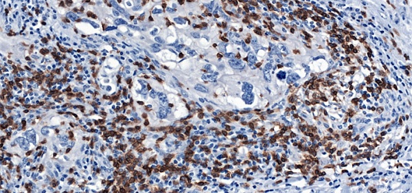 Immunohistochemistry (Formalin/PFA-fixed paraffin-embedded sections) - Anti-CD3 epsilon antibody [CAL54] (ab237707), expandable thumbnail