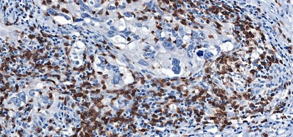 Immunohistochemistry (Formalin/PFA-fixed paraffin-embedded sections) - Anti-CD3 epsilon antibody [CAL54] (AB237707)