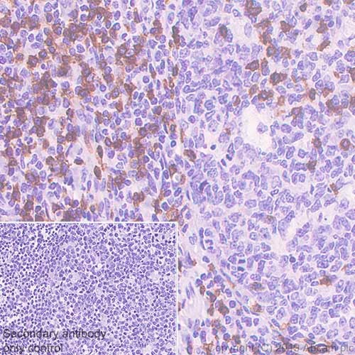 Immunohistochemistry (Formalin/PFA-fixed paraffin-embedded sections) - Anti-CD3 epsilon antibody [CAL54] (AB237707), expandable thumbnail