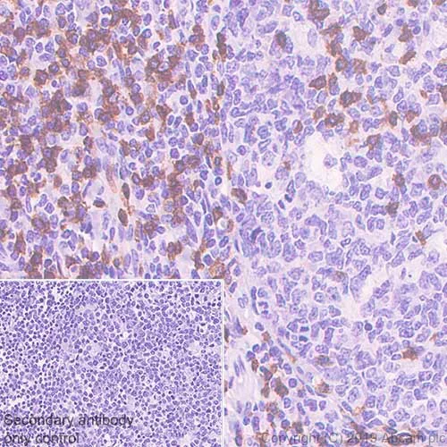 Immunohistochemistry (Formalin/PFA-fixed paraffin-embedded sections) - Anti-CD3 epsilon antibody [CAL54] (AB237707)