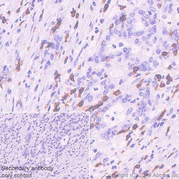 Immunohistochemistry (Formalin/PFA-fixed paraffin-embedded sections) - Anti-CD3 epsilon antibody [CAL54] (AB237707), expandable thumbnail