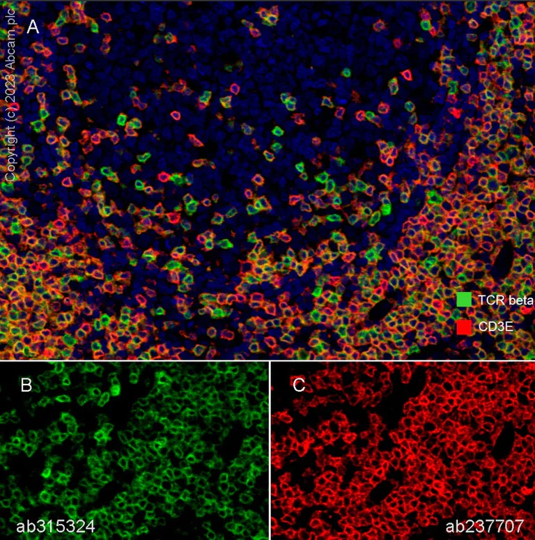 Multiplex immunohistochemistry - Anti-CD3 epsilon antibody [CAL54] (AB237707)