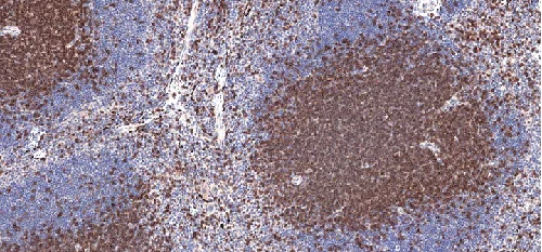 Immunohistochemistry (Formalin/PFA-fixed paraffin-embedded sections) - Anti-CD3 epsilon antibody [CAL57] (AB237721)