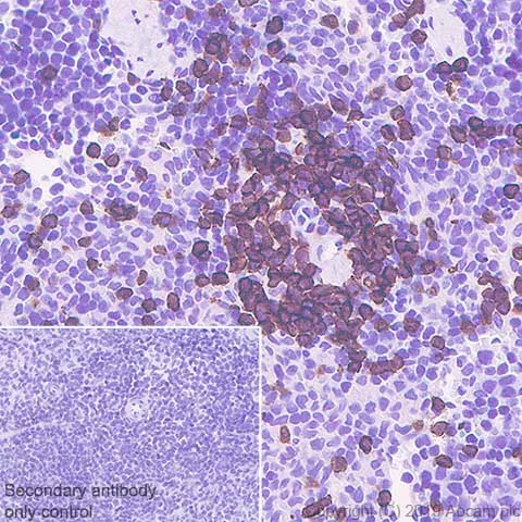 Immunohistochemistry (Formalin/PFA-fixed paraffin-embedded sections) - Anti-CD3 epsilon antibody [CAL57] (AB237721)