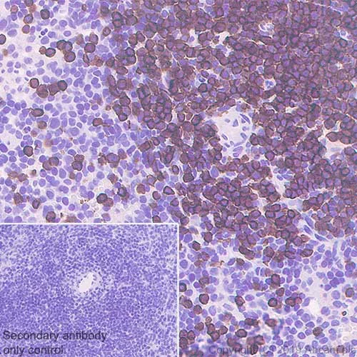 Immunohistochemistry (Formalin/PFA-fixed paraffin-embedded sections) - Anti-CD3 epsilon antibody [CAL57] (AB237721)
