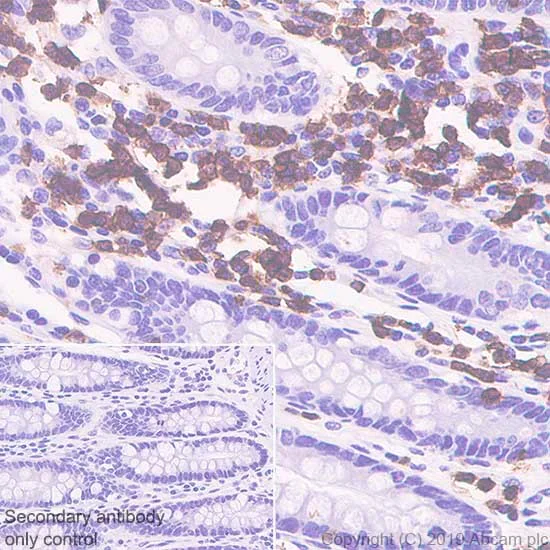 Immunohistochemistry (Formalin/PFA-fixed paraffin-embedded sections) - Anti-CD3 epsilon antibody [CAL57] (AB237721)