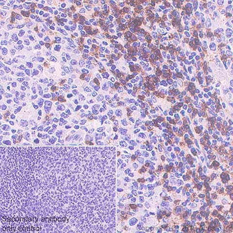 Immunohistochemistry (Formalin/PFA-fixed paraffin-embedded sections) - Anti-CD3 epsilon antibody [CAL57] (AB237721), expandable thumbnail