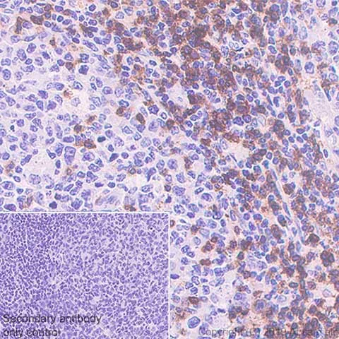 Immunohistochemistry (Formalin/PFA-fixed paraffin-embedded sections) - Anti-CD3 epsilon antibody [CAL57] (AB237721)