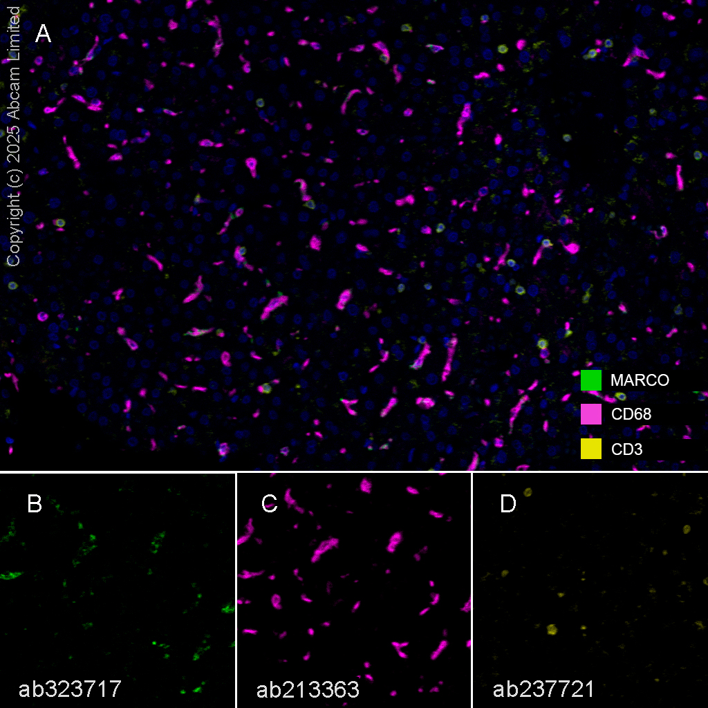 Multiplex immunohistochemistry - Anti-CD3 epsilon antibody [CAL57] (ab237721), expandable thumbnail