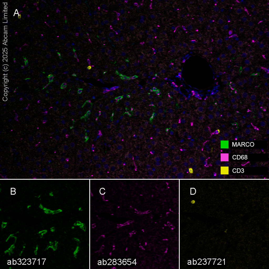 Multiplex immunohistochemistry - Anti-CD3 epsilon antibody [CAL57] (ab237721), expandable thumbnail