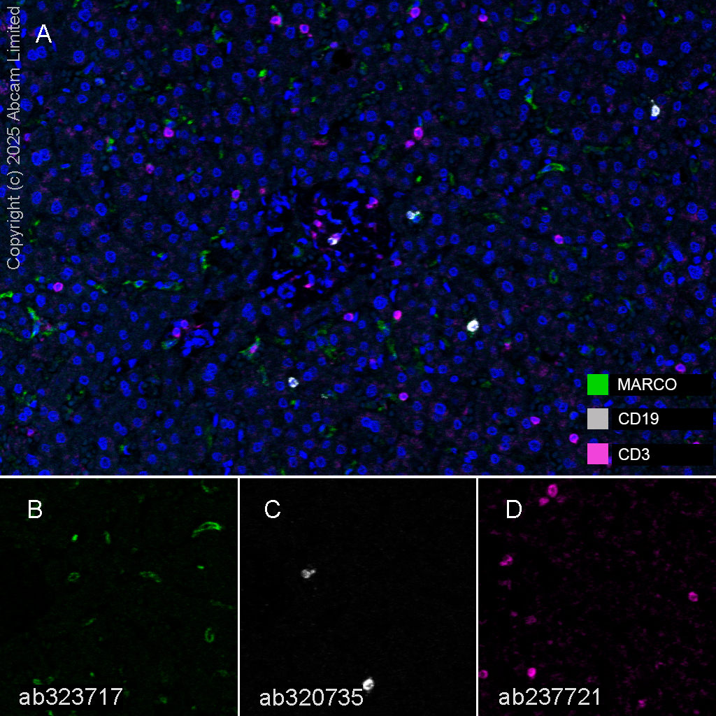 Multiplex immunohistochemistry - Anti-CD3 epsilon antibody [CAL57] (ab237721), expandable thumbnail