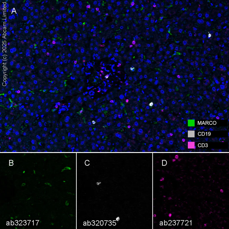 Multiplex immunohistochemistry - Anti-CD3 epsilon antibody [CAL57] (AB237721)