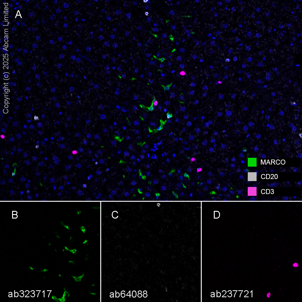 Multiplex immunohistochemistry - Anti-CD3 epsilon antibody [CAL57] (ab237721), expandable thumbnail