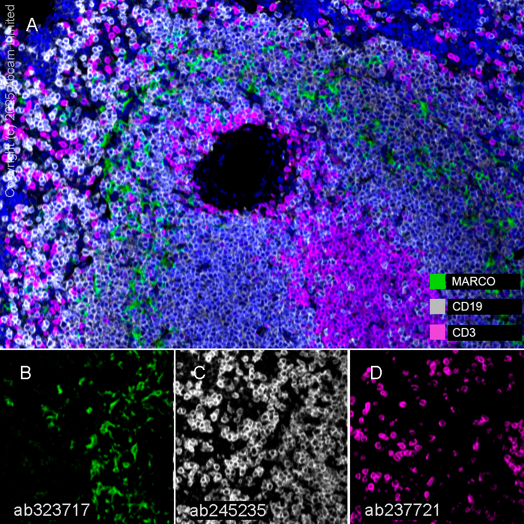 Multiplex immunohistochemistry - Anti-CD3 epsilon antibody [CAL57] (ab237721), expandable thumbnail