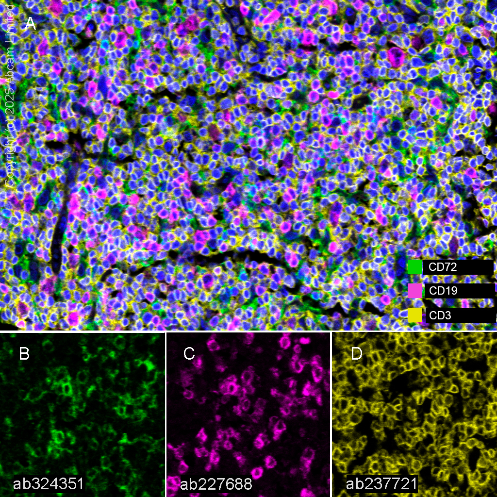 Multiplex immunohistochemistry - Anti-CD3 epsilon antibody [CAL57] (ab237721), expandable thumbnail