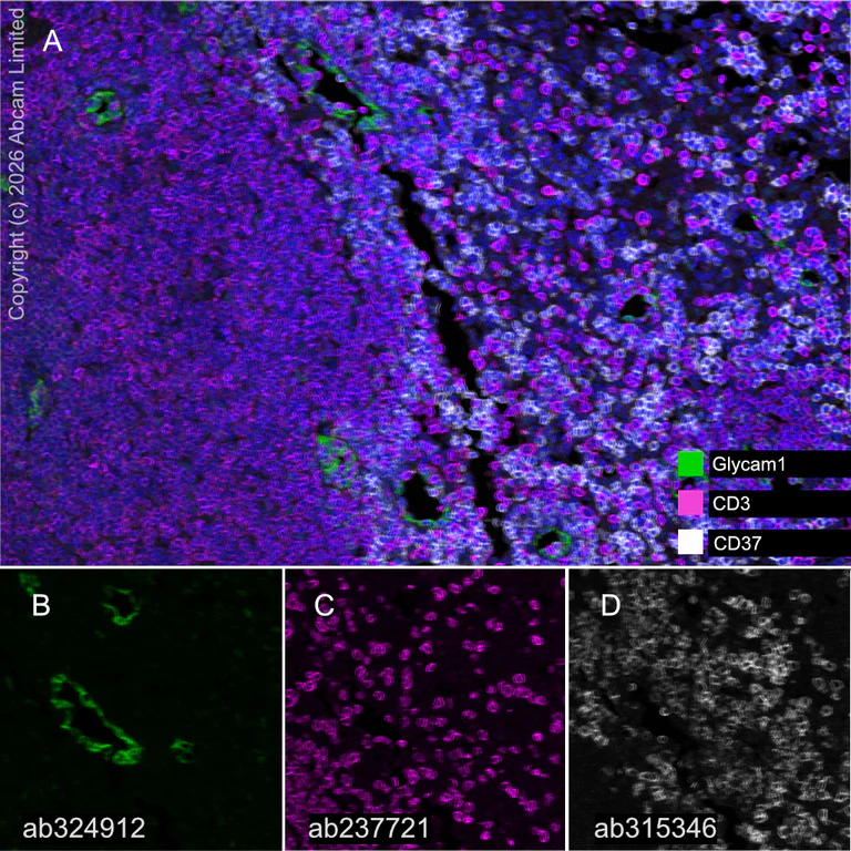 Multiplex immunohistochemistry - Anti-CD3 epsilon antibody [CAL57] (AB237721)