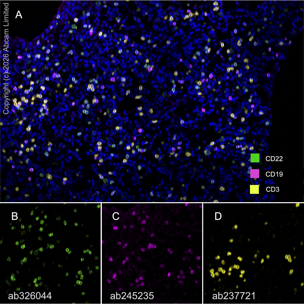 Anti-CD3 epsilon antibody [CAL57] (ab237721) | Abcam