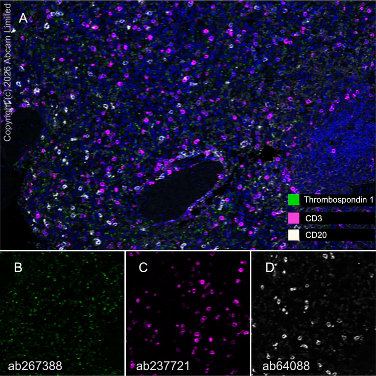 Multiplex immunohistochemistry - Anti-CD3 epsilon antibody [CAL57] (AB237721)
