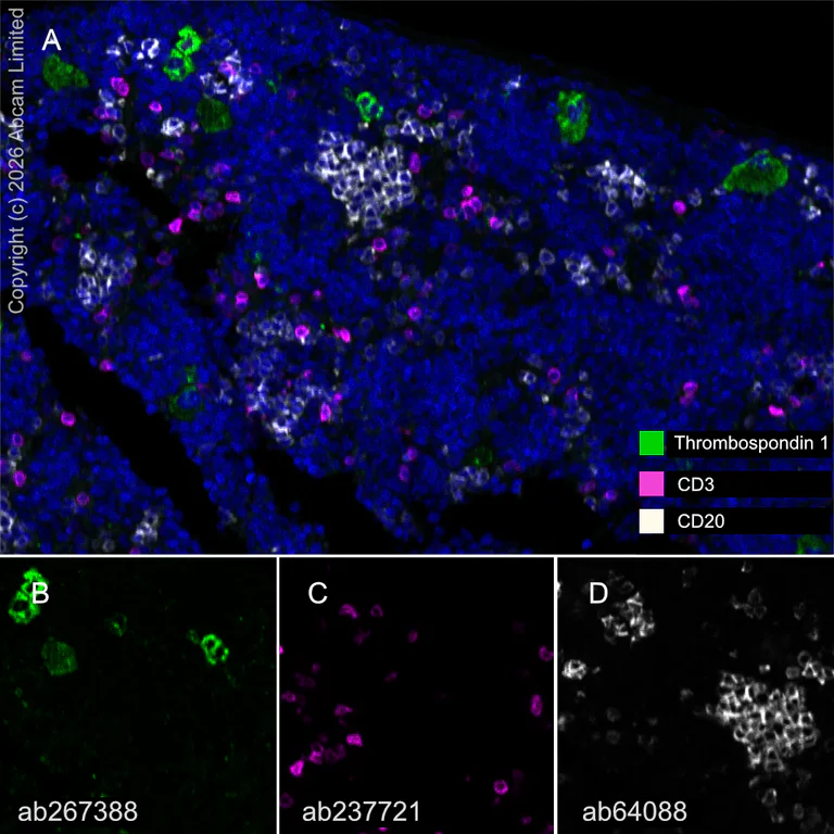 Multiplex immunohistochemistry - Anti-CD3 epsilon antibody [CAL57] (AB237721)