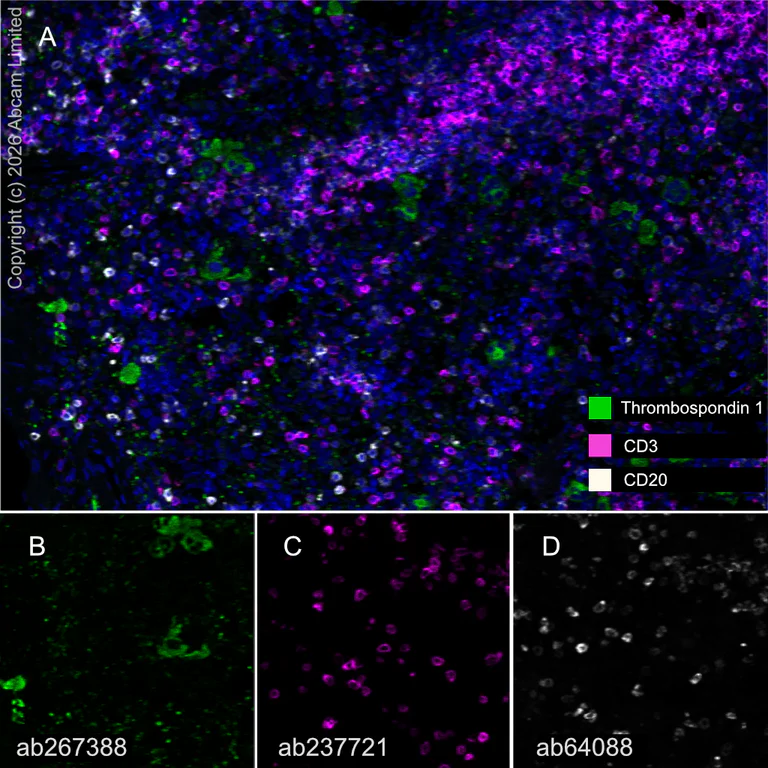 Multiplex immunohistochemistry - Anti-CD3 epsilon antibody [CAL57] (AB237721)