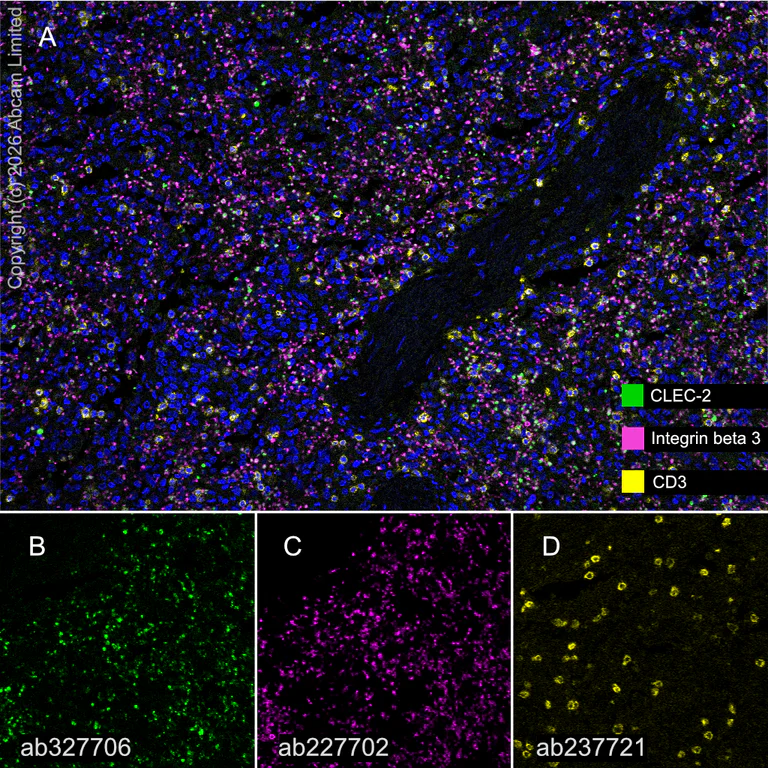 Multiplex immunohistochemistry - Anti-CD3 epsilon antibody [CAL57] (AB237721)