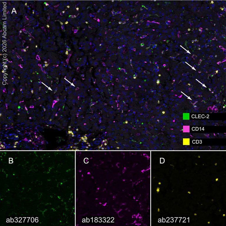 Multiplex immunohistochemistry - Anti-CD3 epsilon antibody [CAL57] (AB237721)