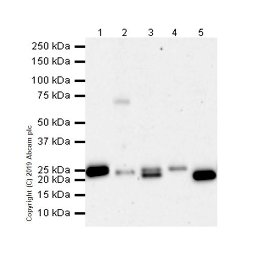 Western blot - Anti-CD3 epsilon antibody [CAL57] (AB237721), expandable thumbnail