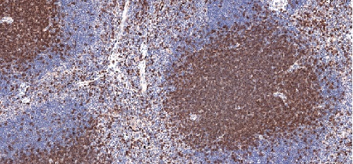 Immunohistochemistry (Formalin/PFA-fixed paraffin-embedded sections) - Anti-CD3 epsilon antibody [CAL57] - BSA and Azide free (ab251607), expandable thumbnail