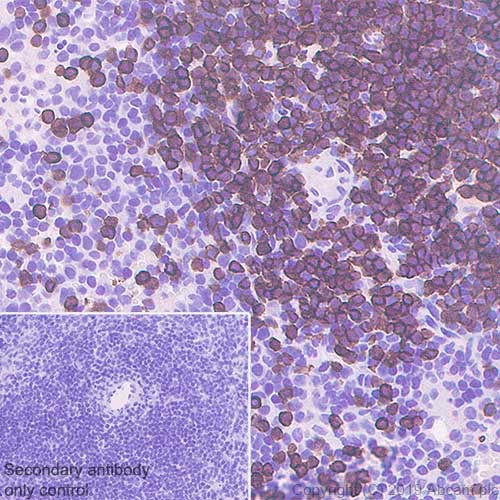 Immunohistochemistry (Formalin/PFA-fixed paraffin-embedded sections) - Anti-CD3 epsilon antibody [CAL57] - BSA and Azide free (ab251607), expandable thumbnail