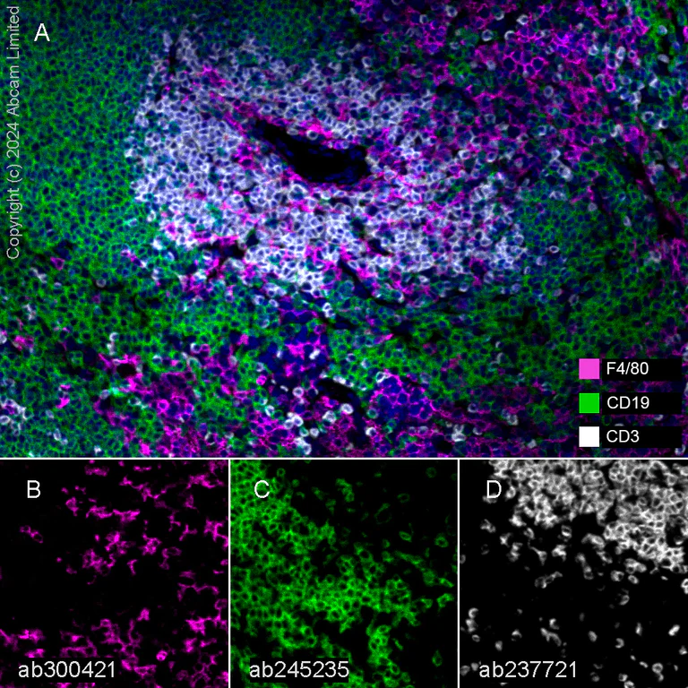 Multiplex immunohistochemistry - Anti-CD3 epsilon antibody [CAL57] - BSA and Azide free (AB251607)