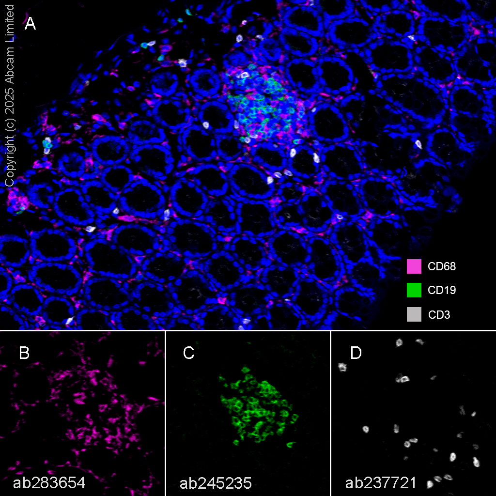 Multiplex immunohistochemistry - Anti-CD3 epsilon antibody [CAL57] - BSA and Azide free (ab251607), expandable thumbnail