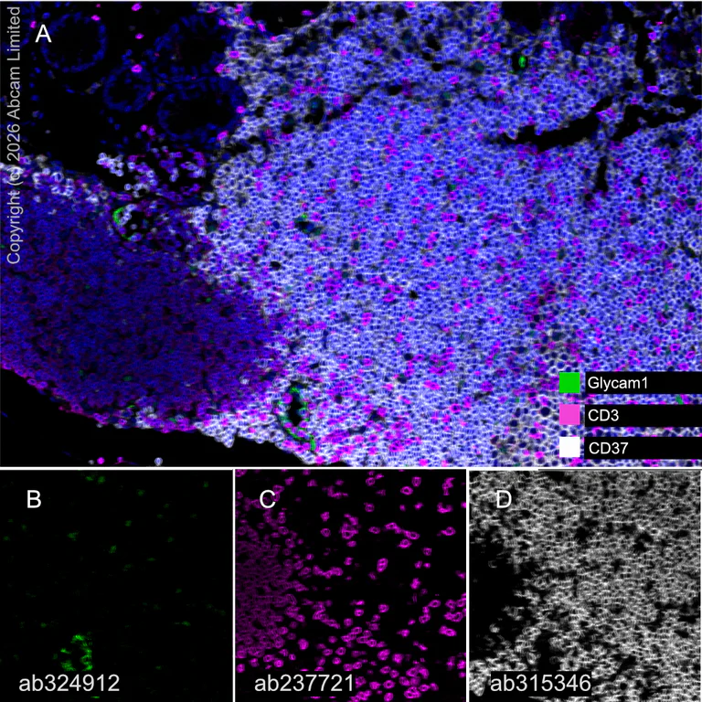 Multiplex immunohistochemistry - Anti-CD3 epsilon antibody [CAL57] - BSA and Azide free (AB251607)