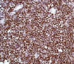 Immunohistochemistry (Formalin/PFA-fixed paraffin-embedded sections) - Anti-CD3 epsilon antibody [E272] - BSA and Azide free (AB203357), expandable thumbnail