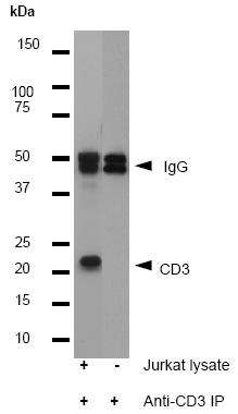 Immunoprecipitation - Anti-CD3 epsilon antibody [E272] - BSA and Azide free (AB203357), expandable thumbnail