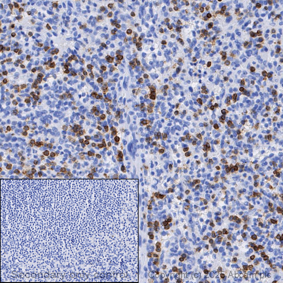 Anti-CD3 epsilon antibody [EP449E] (ab52959) | Abcam